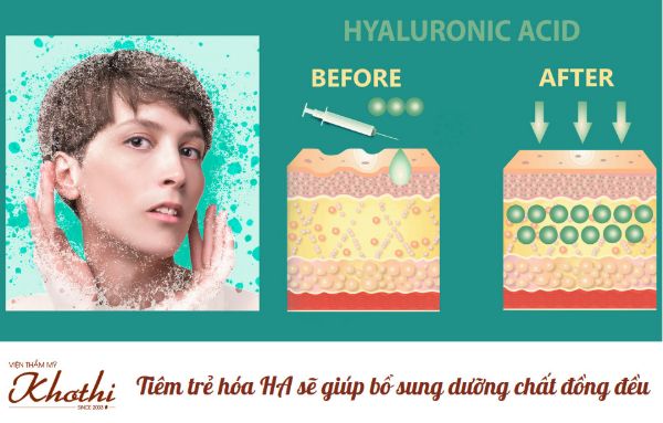 Hiệu quả trước và sau khi tiêm trẻ hóa HA.
