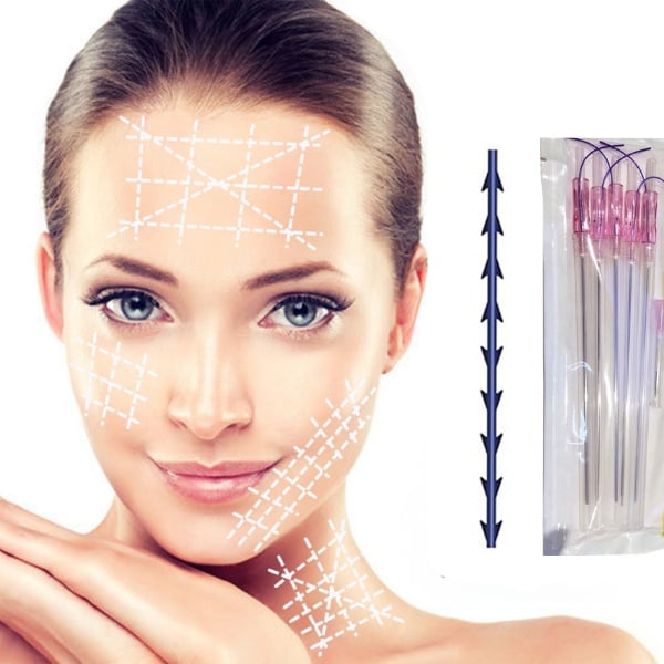 Cấy chỉ collagen kích thích quá trình tự chữa lành và sản sinh collagen mới của cơ thể