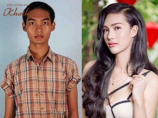 Minh Tiến - Tây Hà trước và sau khi thẩm mỹ Minh Tiến - Tây Hà trước và sau khi thẩm mỹ