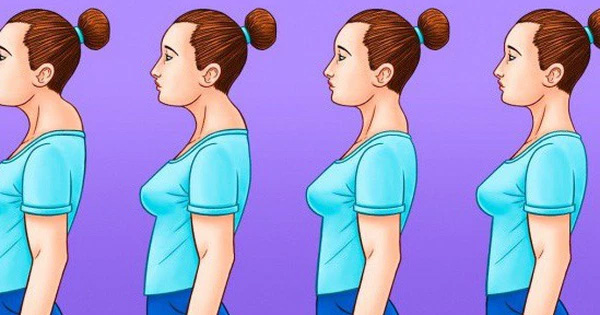 Tư thế đứng sai tích tụ mỡ