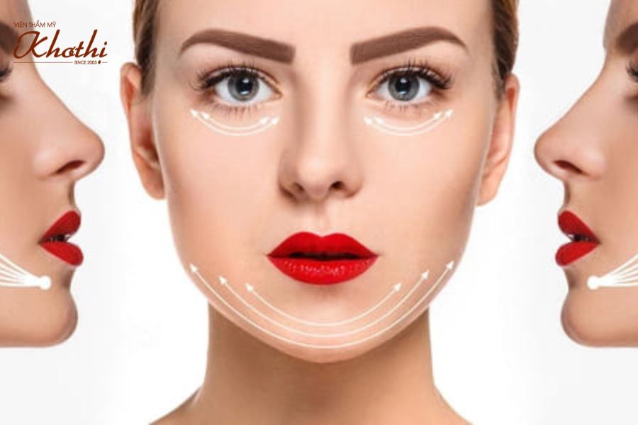 Tư vấn căng da bằng chỉ Khơ Thị