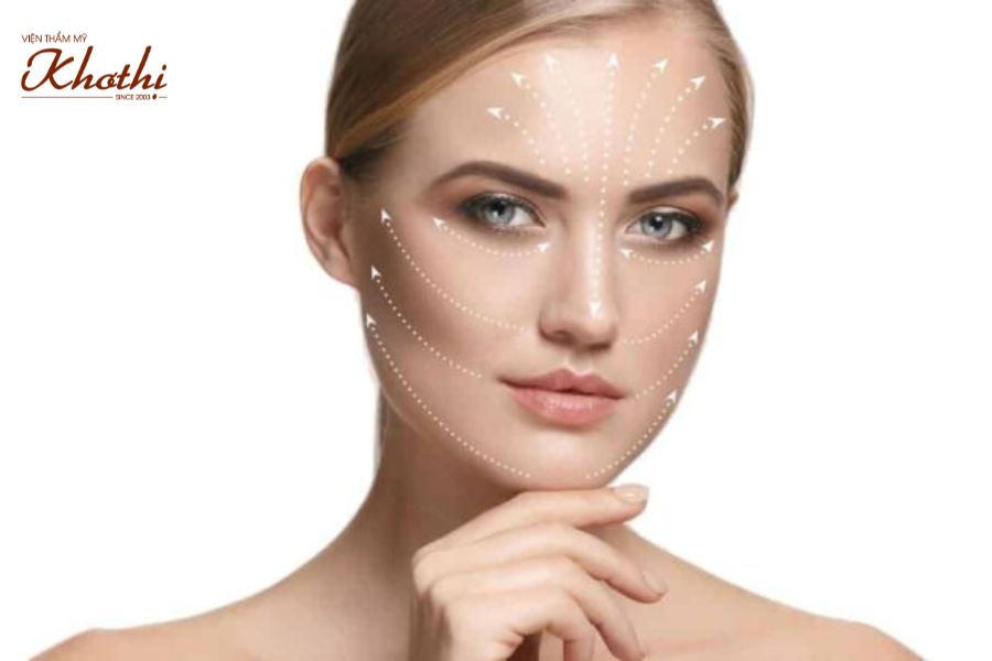 Tư vấn căng da bằng chỉ Khơ Thị
