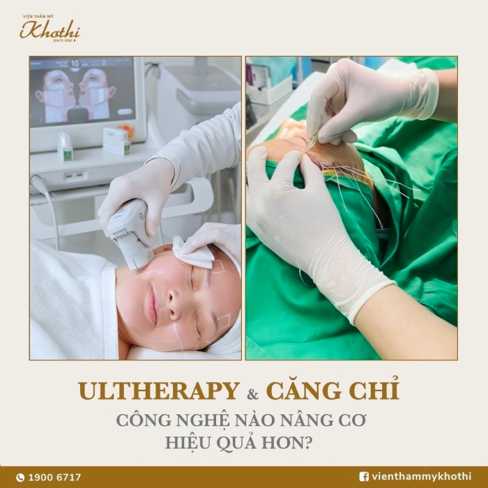 Ultherapy & Căng chỉ collagen là hai công nghệ nâng cơ phổ biến hiện nay.