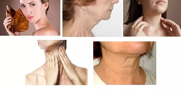 Công nghệ trẻ hóa da Ulthera Ionic có thể áp dụng được cho nhiều vùng da khác nhau