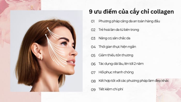 09 ưu điểm của cấy chỉ collagen