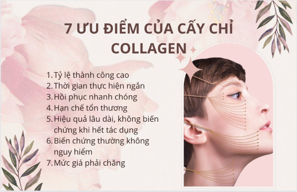 Cấy chỉ collagen có những ưu điểm vượt trội