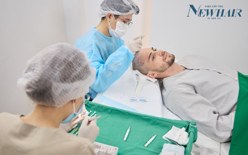 cấy tóc tự thân newhair