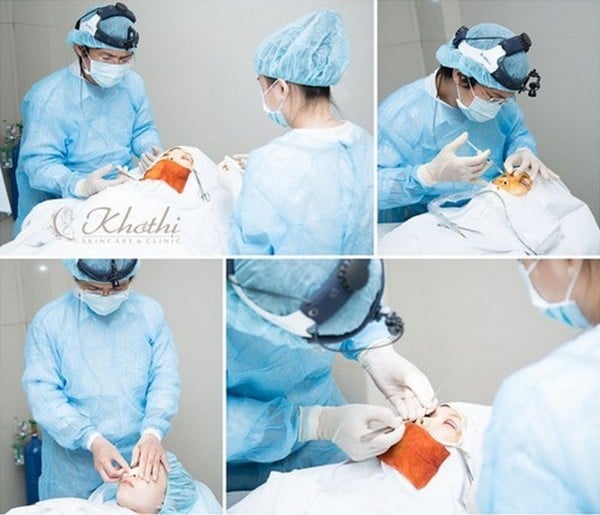 Bác sĩ phẫu thuật thẩm mỹ cho Ngọc anh tại Khơ Thị