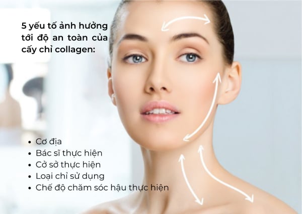 5 yếu tố ảnh hưởng tới độ an toàn của phương pháp cấy chỉ collagen.
