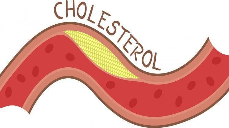 Cholesterol là gì? Các loại, chức năng, cách giảm Cholesterol máu