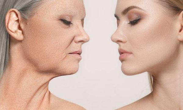 Làn da khô sần, nếp nhăn là dấu hiệu cơ thể thiếu hụt collagen
