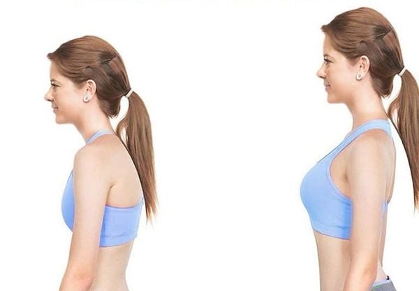 dấu hiệu nhận biết gù lưng