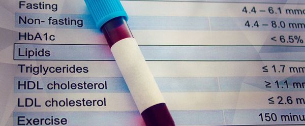 Xét nghiệm máu để nắm được chỉ số cholesterol