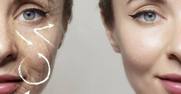 Dấu hiệu nhận biết cơ thể suy giảm collagen
