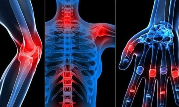 Glucosamine có tác dụng cải thiện các vấn đề về xương, sụn khớp