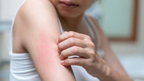 Người dị ứng với thành phần collagen không nên uống collagen