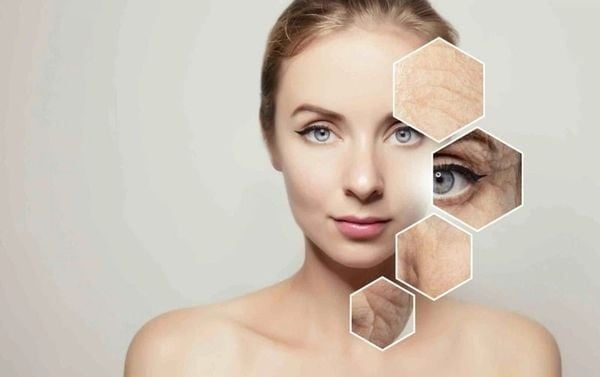Collagen giúp cải thiện độ đàn hồi, làm mờ nếp nhăn