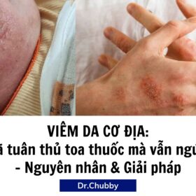 Viêm Da Cơ Địa Dù Đã Dùng Thuốc Vẫn Ngứa: Nguyên Nhân & Cách Xử Lý