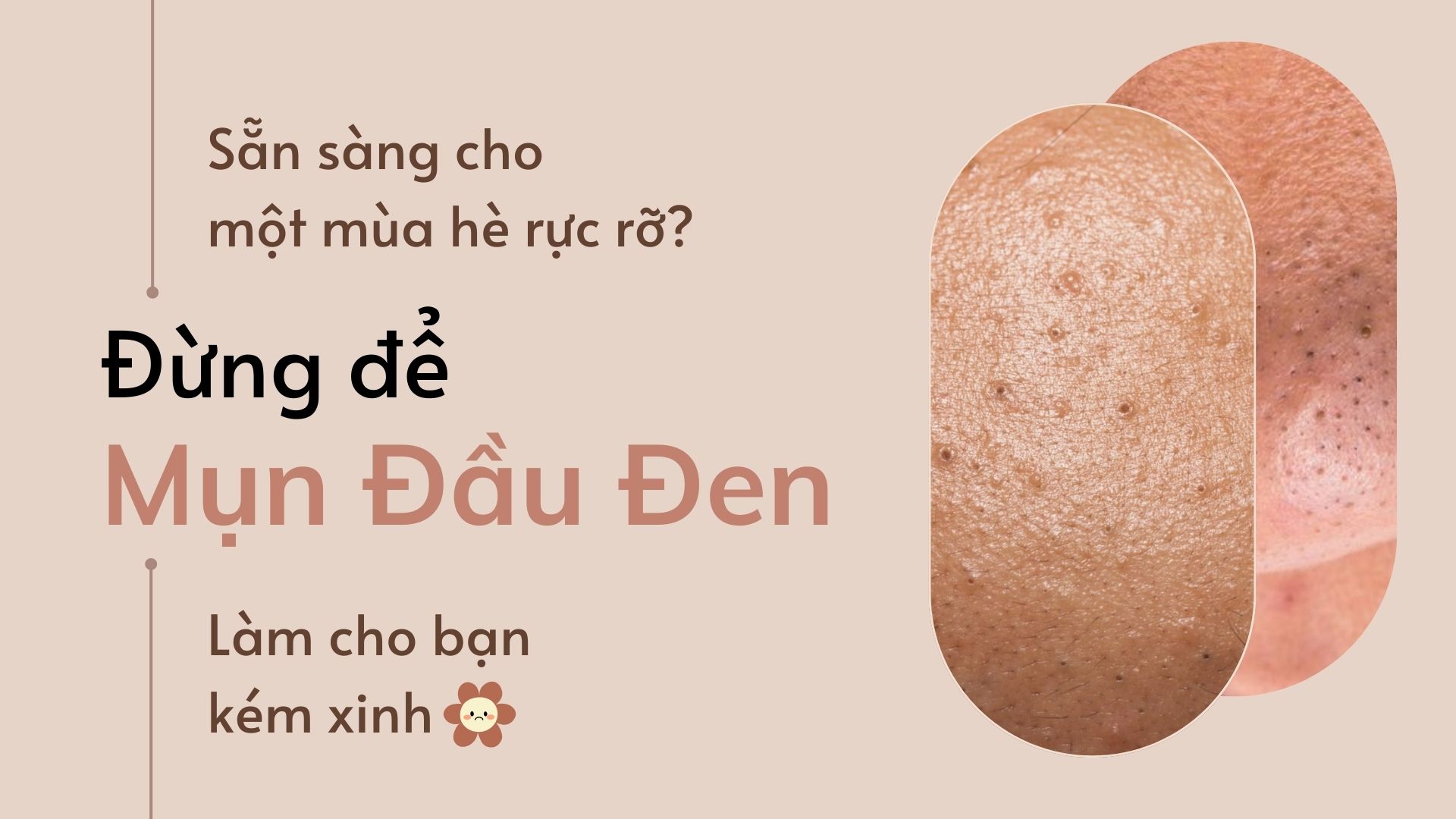 Trị Mụn Đầu Đen Ở Mũi: Nguyên Nhân Và Cách Xử Lý Hiệu Quả