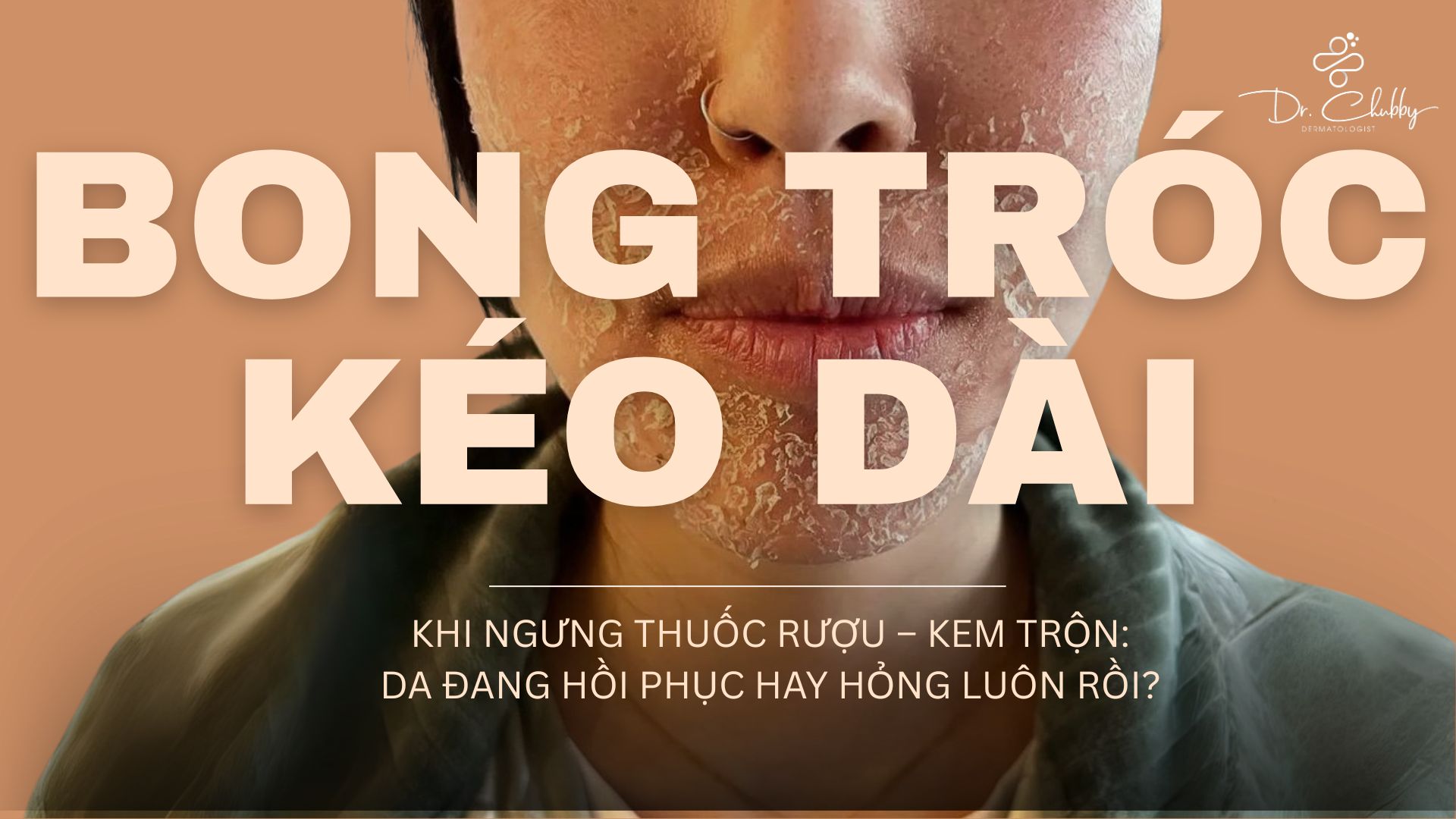 Da bong tróc sau khi ngưng kem trộn: Phục hồi hay hư vĩnh viễn?