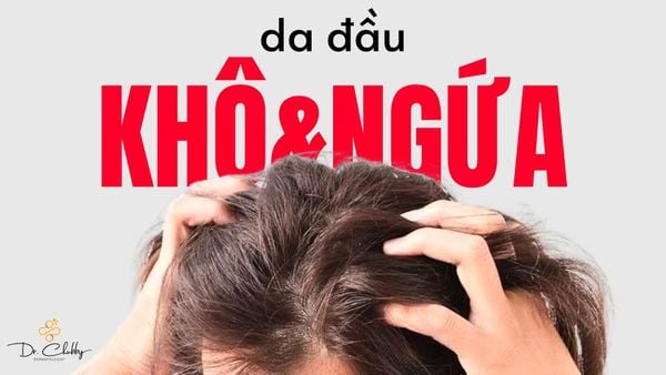 Khô, Ngứa, Gàu Mãi Không Hết: Đừng Chỉ Đổi Dầu Gội, Hãy Đi Khám!