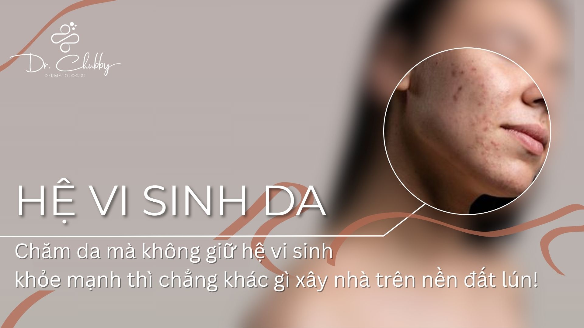 Hệ Vi Sinh Trên Da Là Gì? Bí Quyết Giữ Da Khỏe Từ Gốc