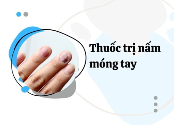 Nấm móng và những tips điều trị đơn giản