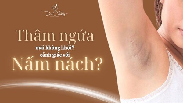 THÂM NGỨA NÁCH MÃI KHÔNG KHỎI? CẢNH GIÁC VỚI NẤM NÁCH!