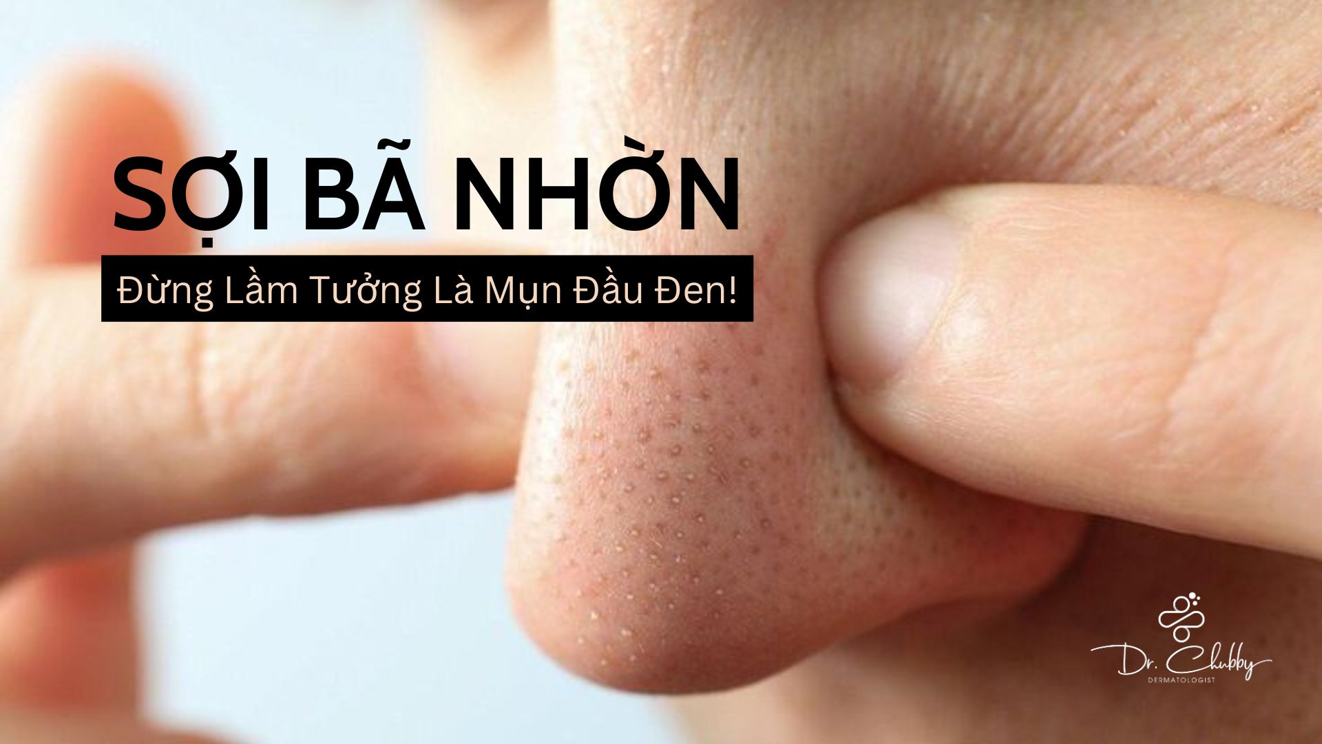 Sợi Bã Nhờn Là Gì? Đừng Nhầm Với Mụn Đầu Đen!