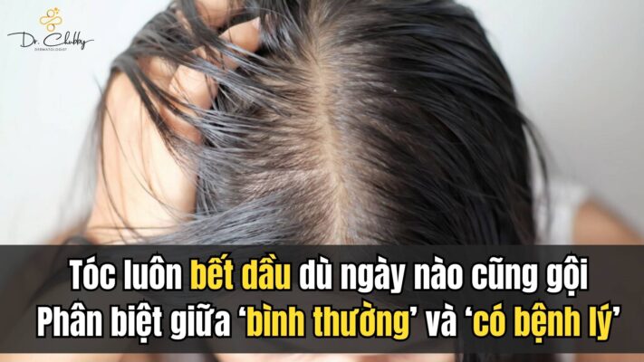 DA ĐẦU BẾT NHƯ CHƯA GỘI – VẤN ĐỀ BỆNH LÝ HAY ĐƠN THUẦN LÀ THÓI QUEN?