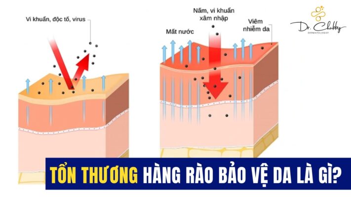 Tổn Thương Hàng Rào Bảo Vệ Da: Dấu Hiệu & Cách Phục Hồi Hiệu Quả