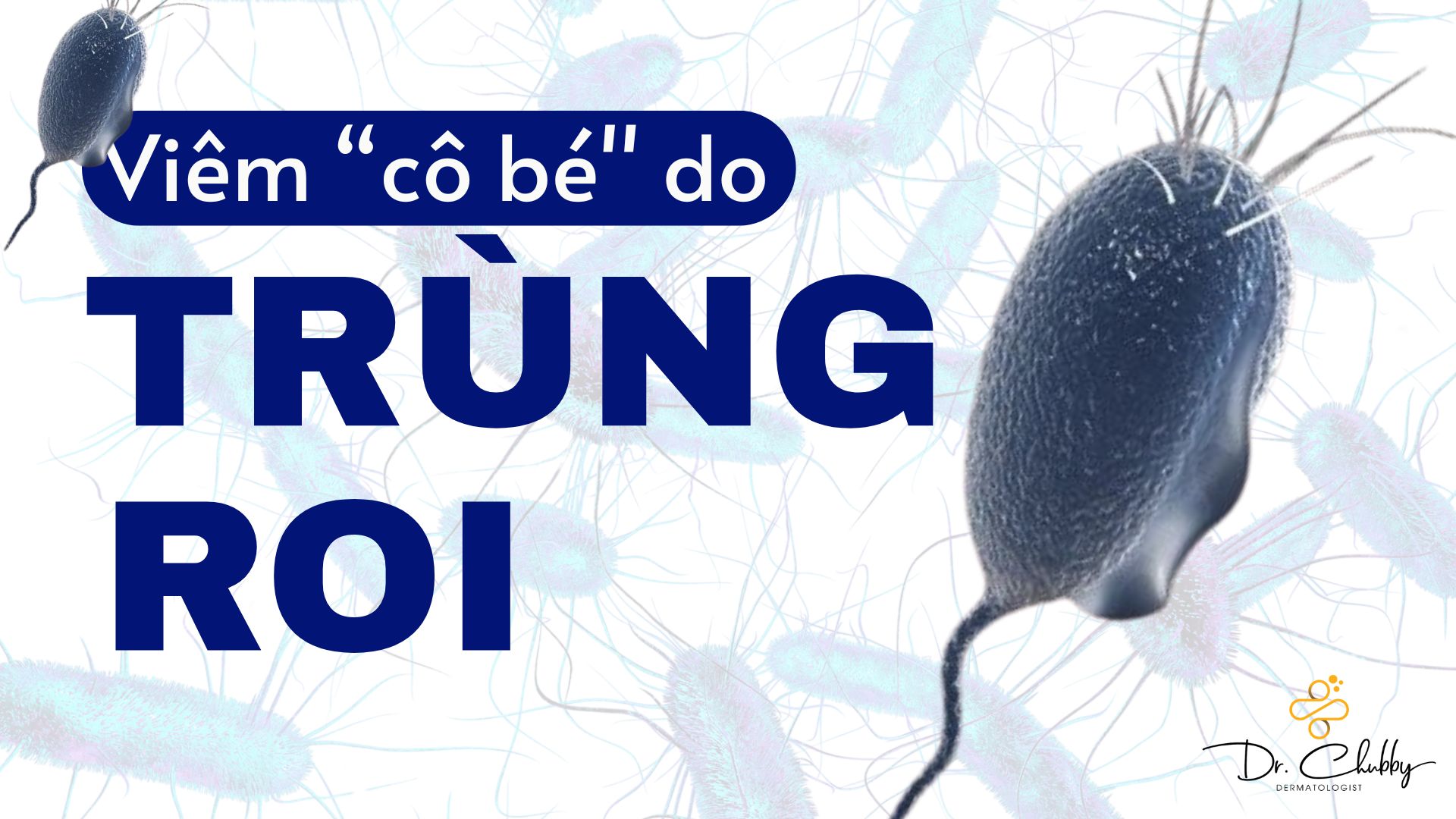 Viêm Vùng Kín Do Trùng Roi: Dấu Hiệu, Cách Điều Trị Và Phòng Ngừa