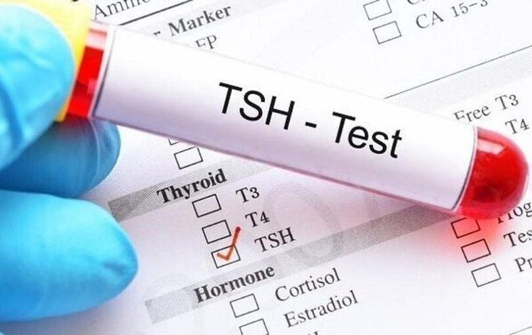 xét nghiệm hormone: LH, FSH, Testosterone, Insulin, TSH