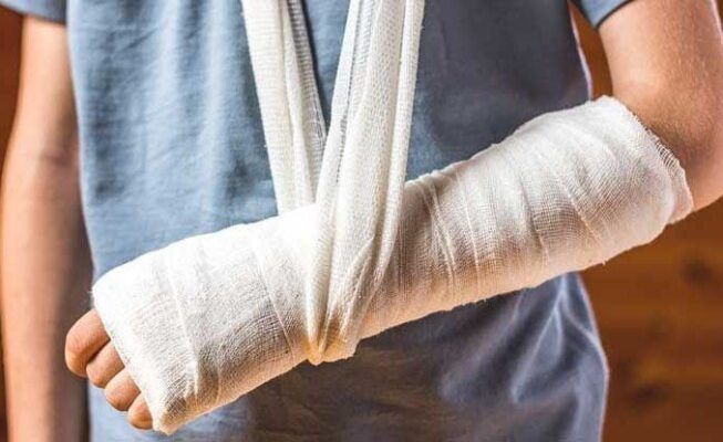 Dấu hiệu của loãng xương nặng- gãy xương liên tục