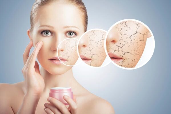 Lưu ý khi chọn sản phẩm dưỡng ẩm cho viêm da cơ địa