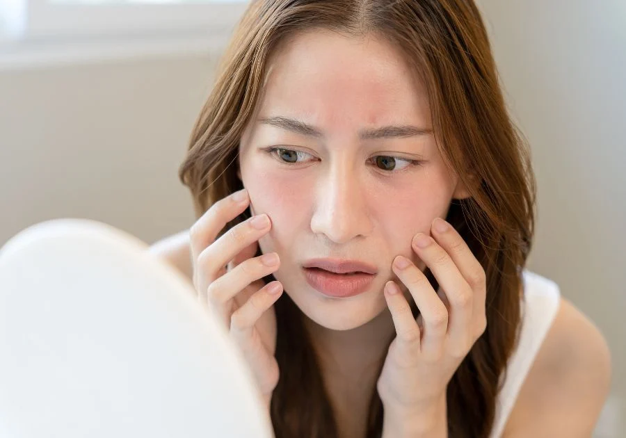 da dễ đỏ rát là một trong những dấu hiệu hệ vi sinh trên da đã suy yếu