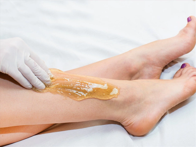 wax lông có thể dẫn đến viêm nang lông