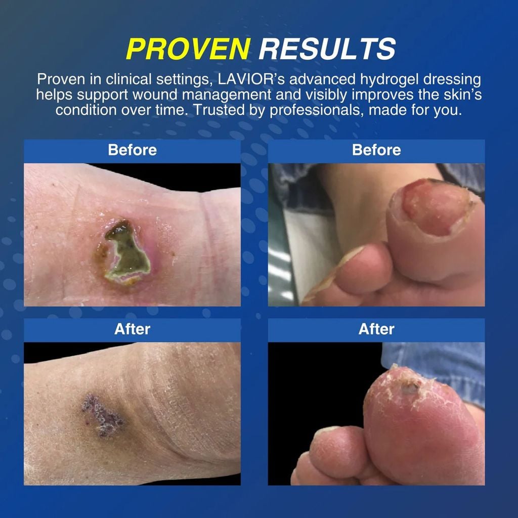 Kết quả phục hồi vết thương ấn tượng, có nghiên cứu lâm sàng