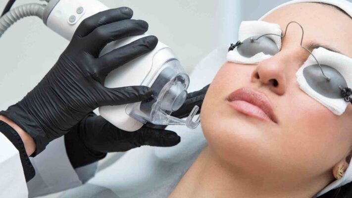 fractional laser