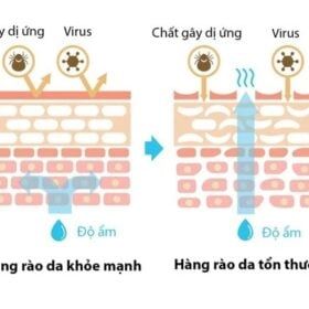 Hàng rào bảo vệ da là thế nào?