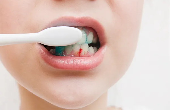 Tại sao trẻ cần vitamin?