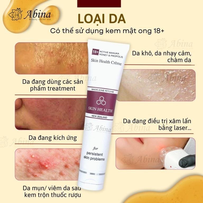 Kem dưỡng ẩm phục hồi da nhạy cảm từ mật ong manuka 18+