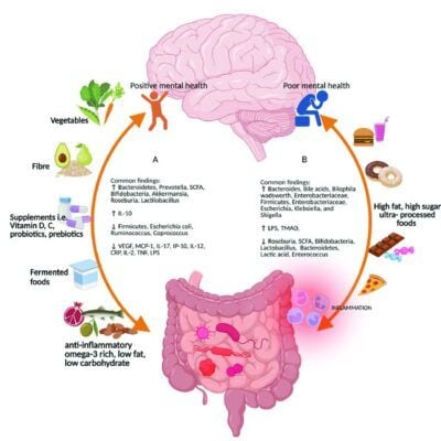 Mối tương quan giữa não và ruột