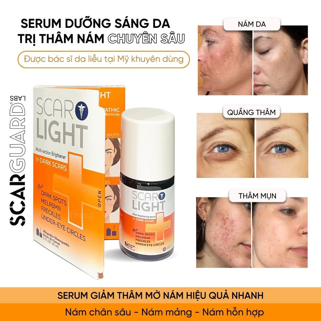 Serum đặc trị nám, đốm thâm Scarguard Scarlight Serum 15ml