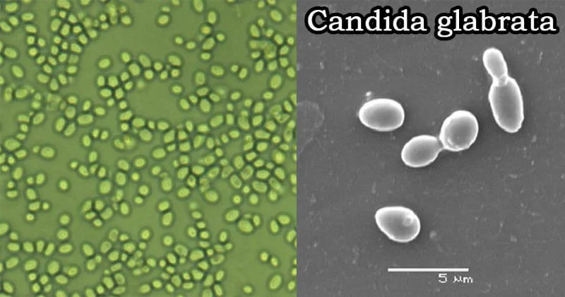 nấm vùng kín do Candida glabrata