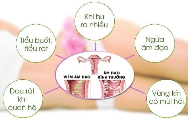Nguyên nhân gây viêm vùng kín