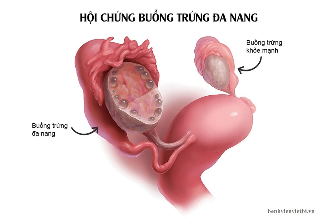 DẬY THÌ MUỘN (SAU 16 TUỔI) – ĐIỀU GÌ CẦN LƯU Ý?