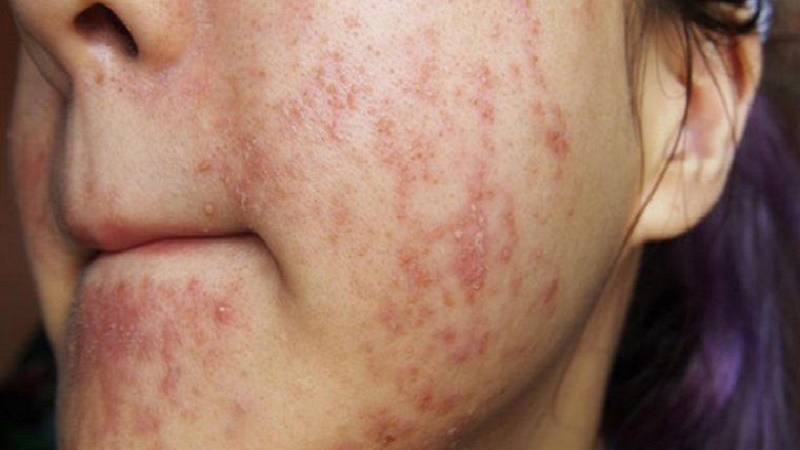 Trường Hợp Thực Tế – Đau Lòng Nhưng Cảnh Tỉnh