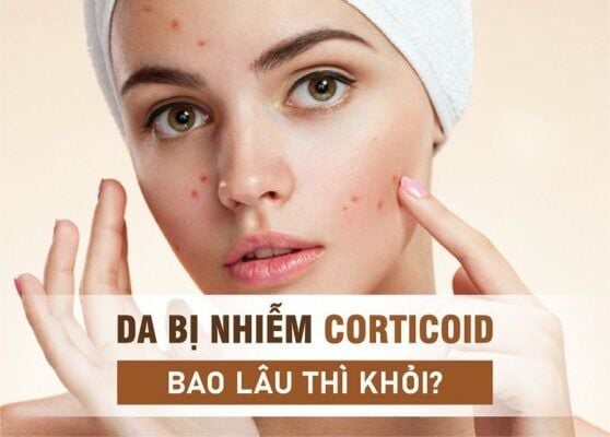 Phục hồi da bị nhiễm corticoid