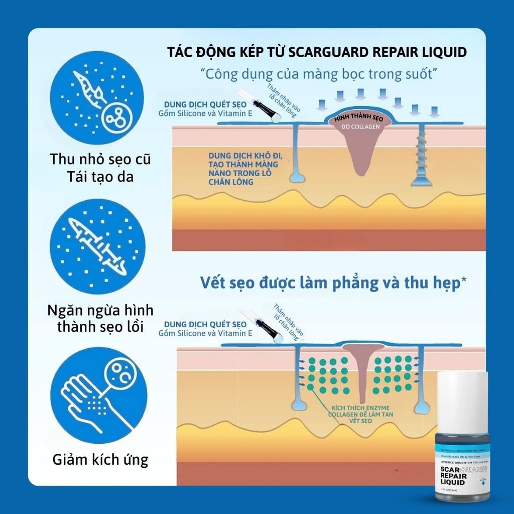 Gel Trị Sẹo Lồi Scarguard Repair Liquid 15ml